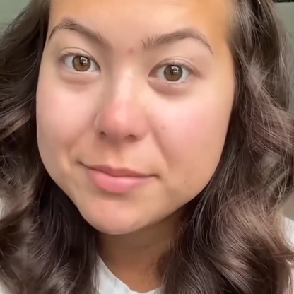 SKENS Patchs Nez - 8 Patchs - DISPONIBLE À NOUVEAU !